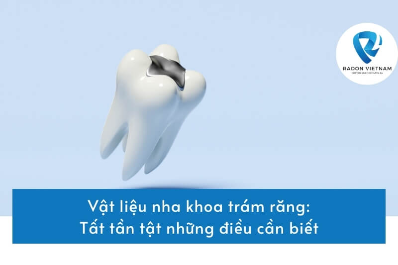 Vật liệu nha khoa trám răng: Tất tần tật những điều cần biết